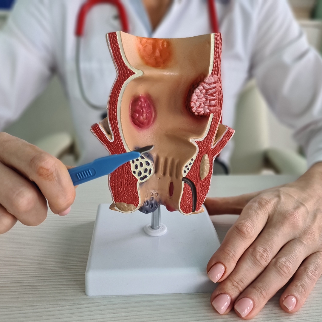 Gastritis